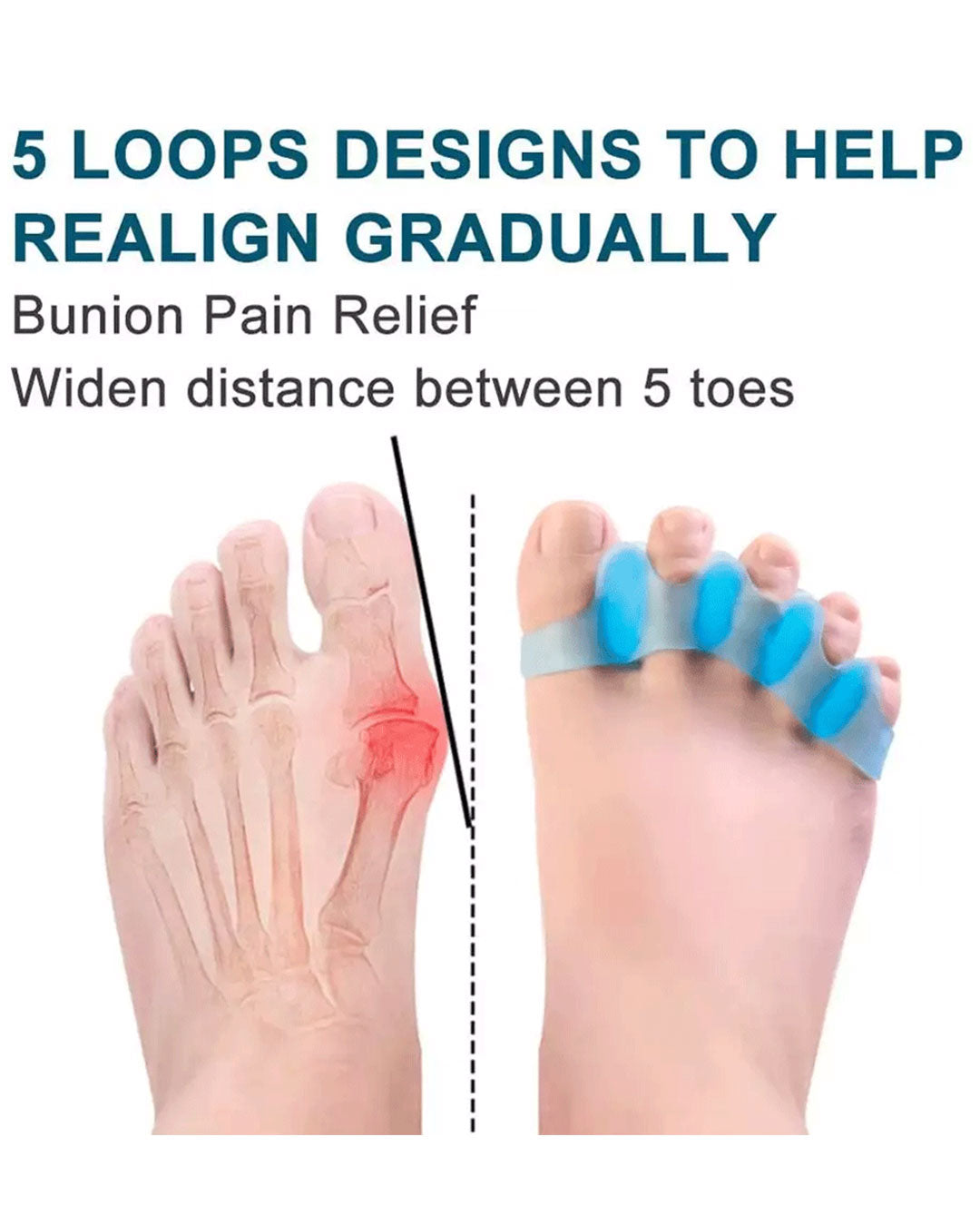 Posture Toes - Active