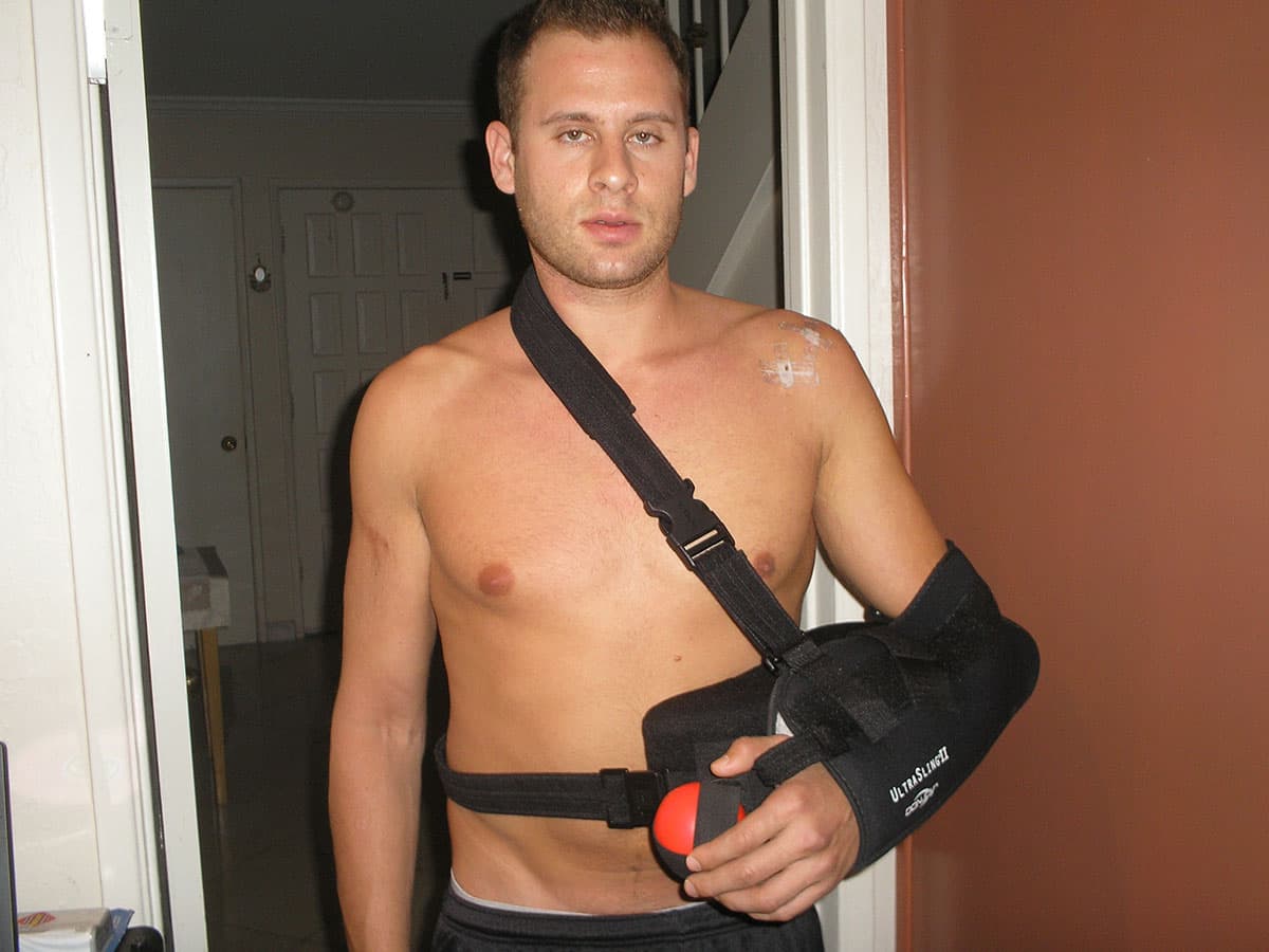 Mike Boshnack after shoulder surgery, the injury that led him to corrective exercise