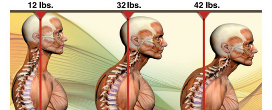forward head posture